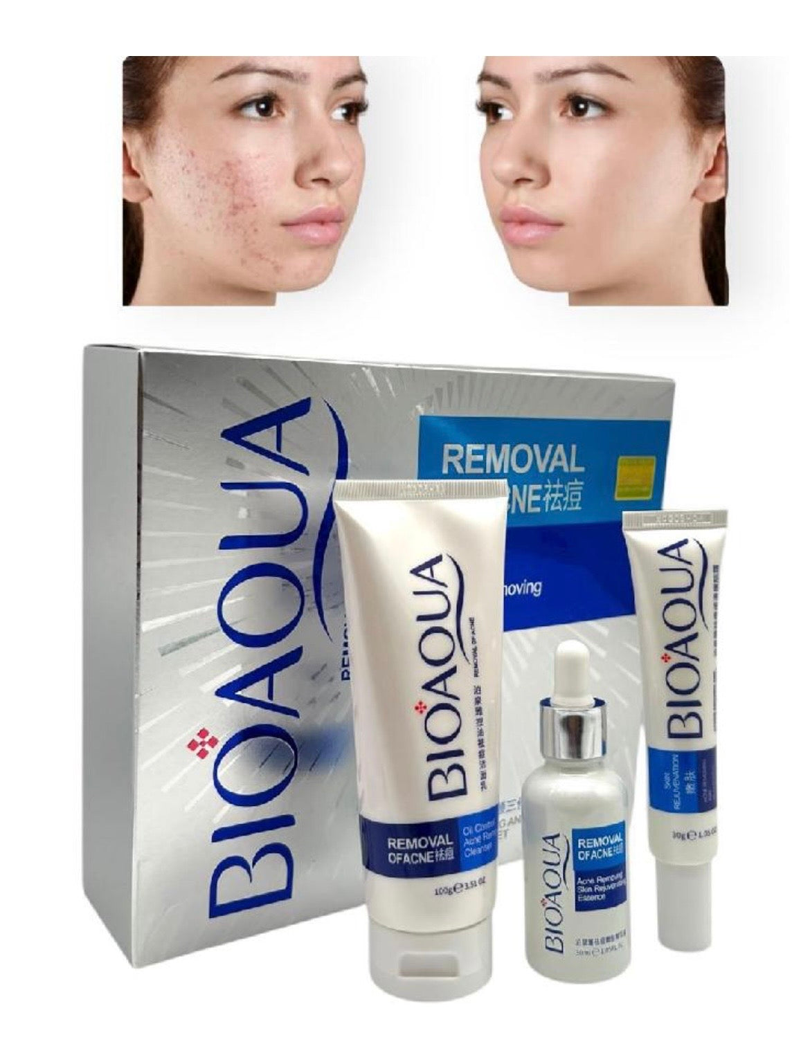 Kit antiacné bioaqua